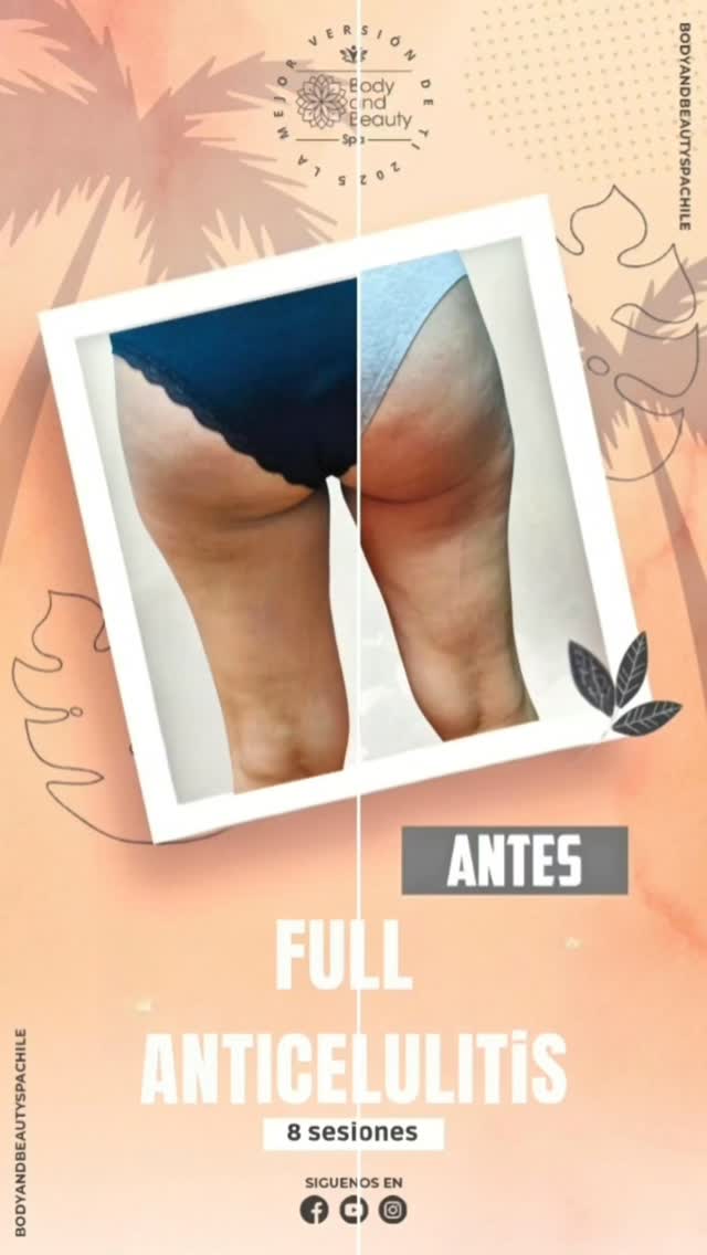 Tratamiento 11