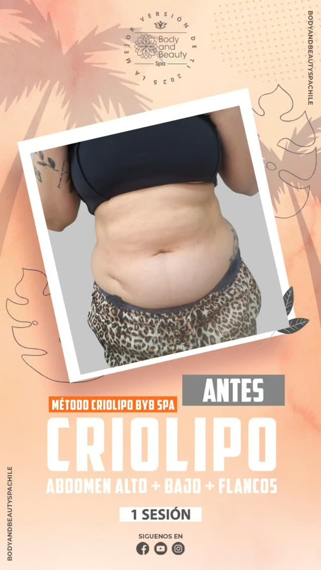 Tratamiento 9